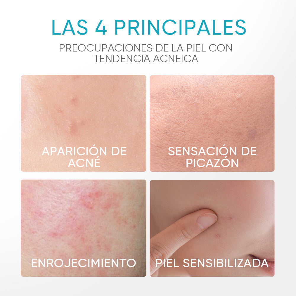 Gel Calmante para Acné con 5% de Pantenol