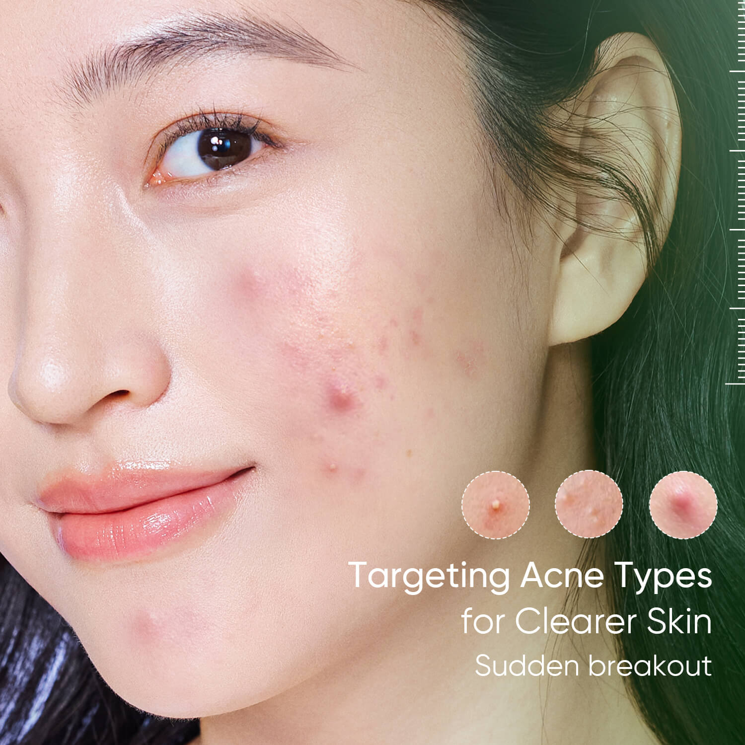 Loción Secante Antiacné Tratamiento Nocturno para Imperfecciones